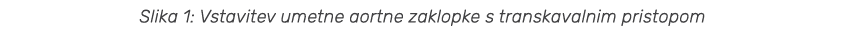 Slika 1: Vstavitev umetne aortne zaklopke s transkavalnim pristopom